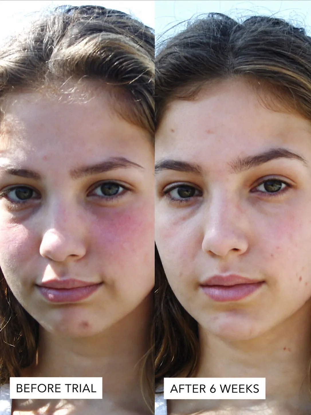 Customer-provided side-by-side skin comparison before trial and after six weeks