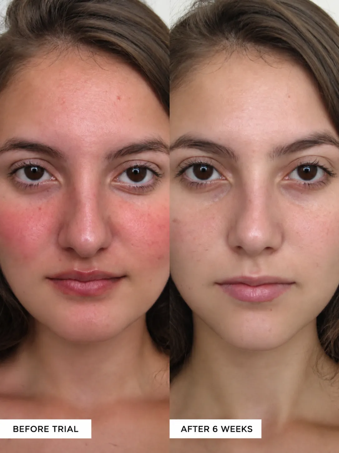 Second customer-provided side-by-side skin comparison before trial and after six weeks